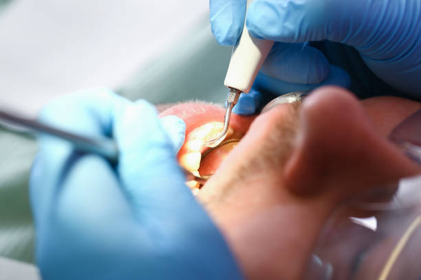 Best Emergency Denture Repair in Monessen, PA