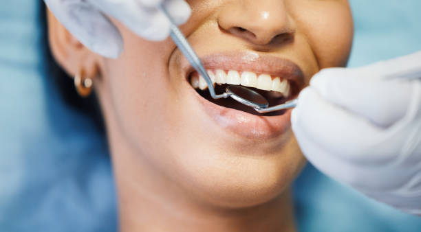 Best Emergency Tooth Extraction in Monessen, PA